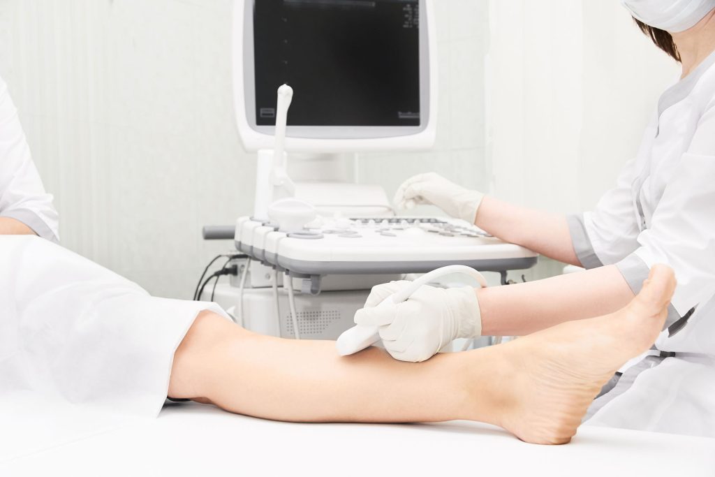 venous disease