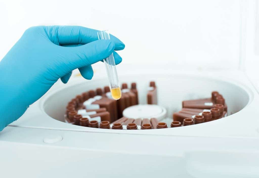 Laboratory technician holding a sample test tube above a medical centrifuge machine for Cardiac Testing