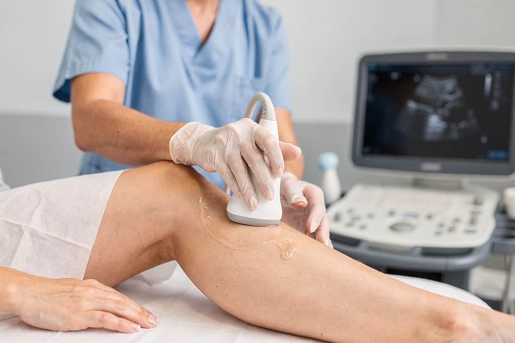 Ultrasound technician performing a vascular duplex scan on a patient's lower leg for vascular care